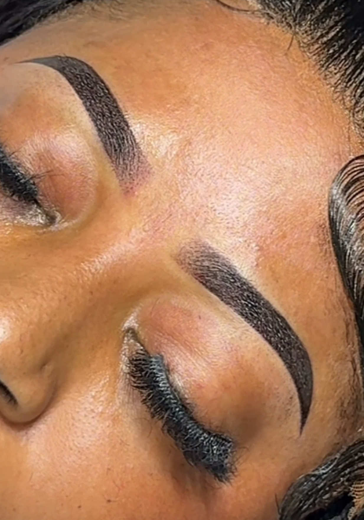 @the_brow_surgeon