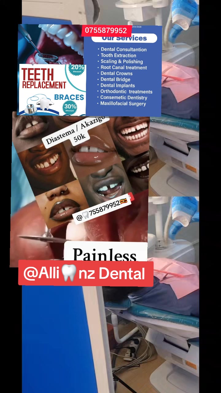 @Allianz Dental studio🦷🦷🇺🇬