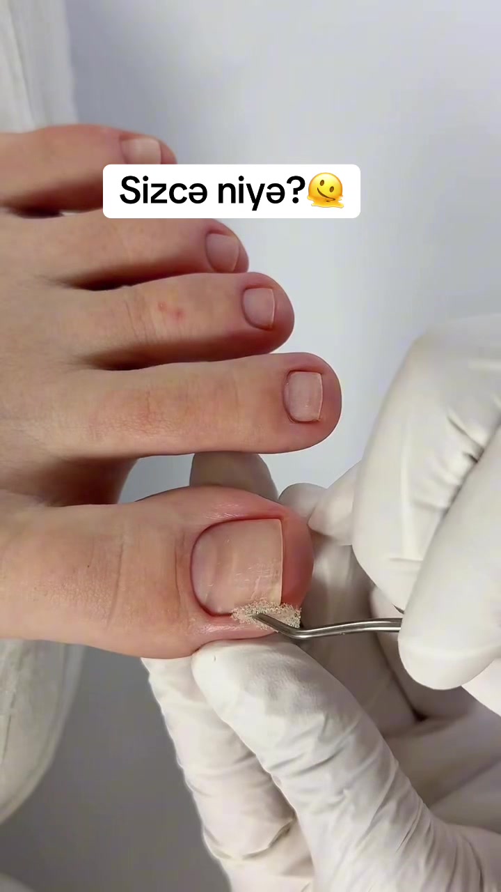@Aygun🦂