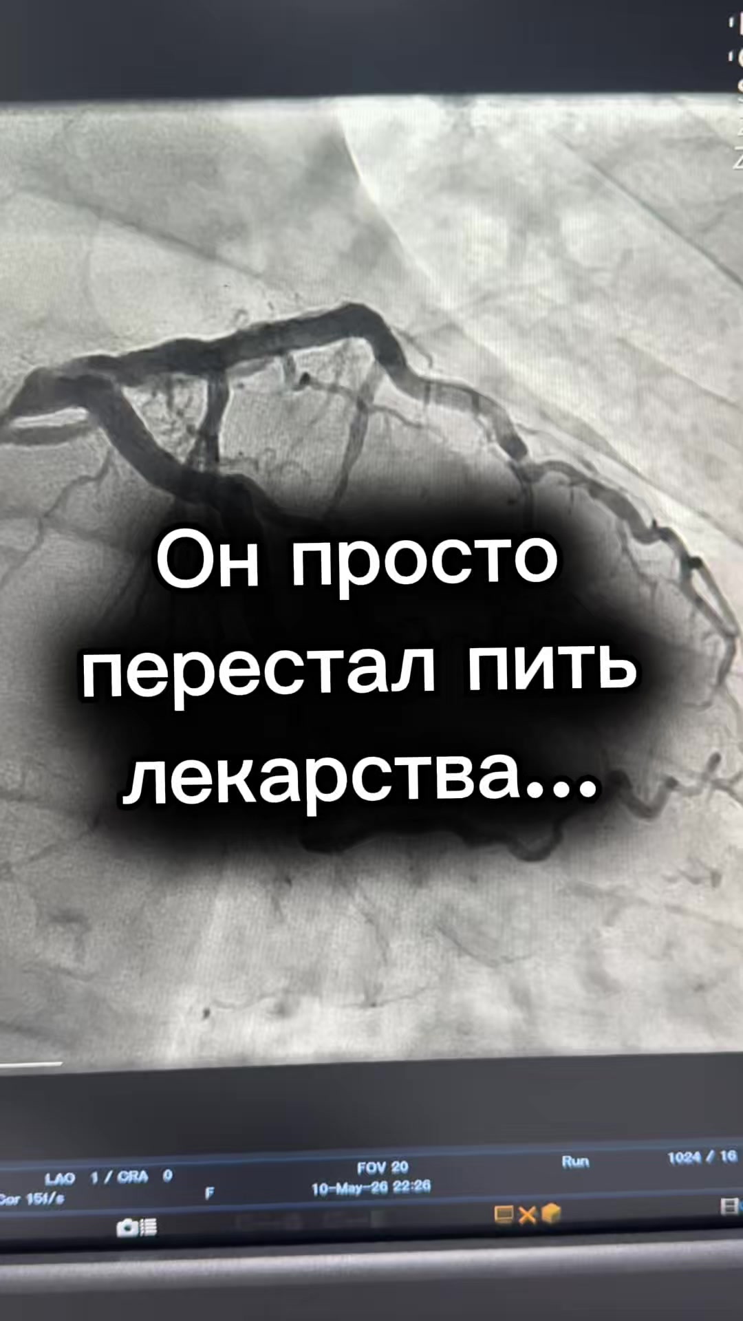 @Кардиолог / Аспет