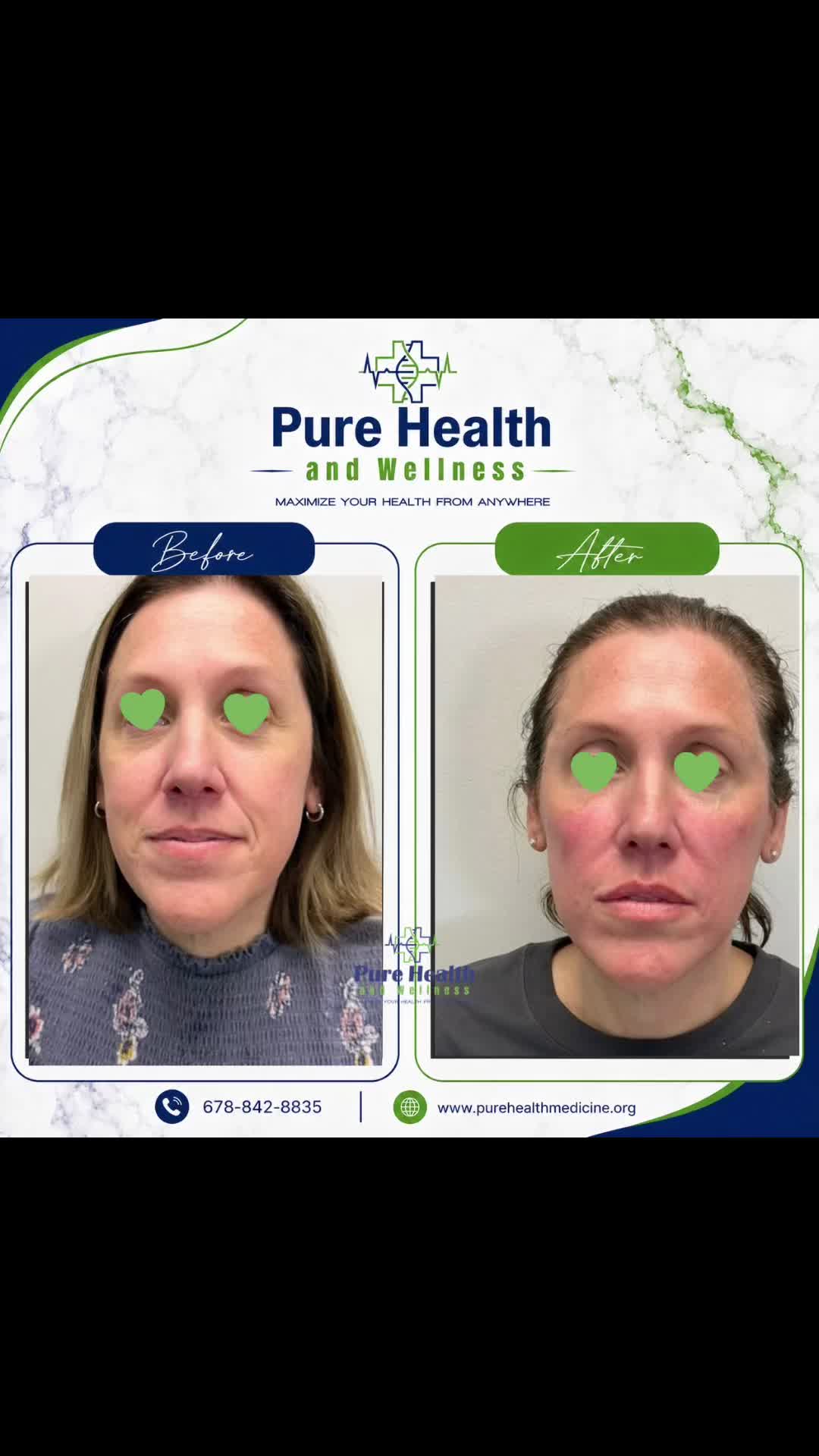 @PureHealthand_Wellness