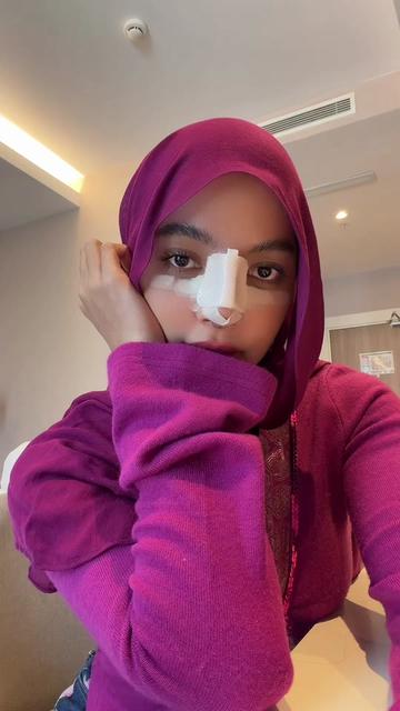 @Oklin Fia