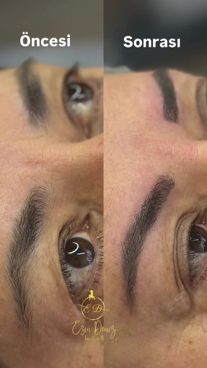 @Esin Deniz Beauty center