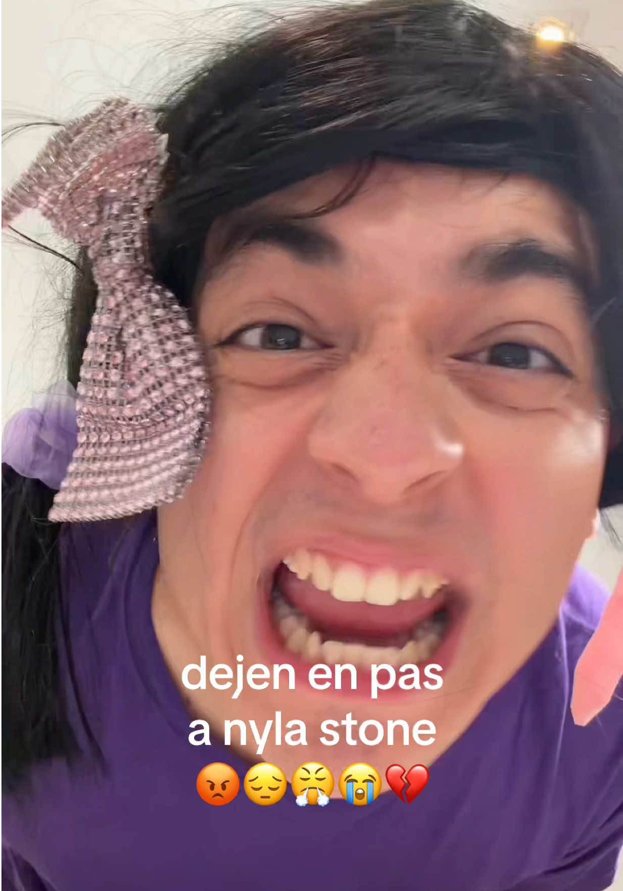 @Jordy Escoto