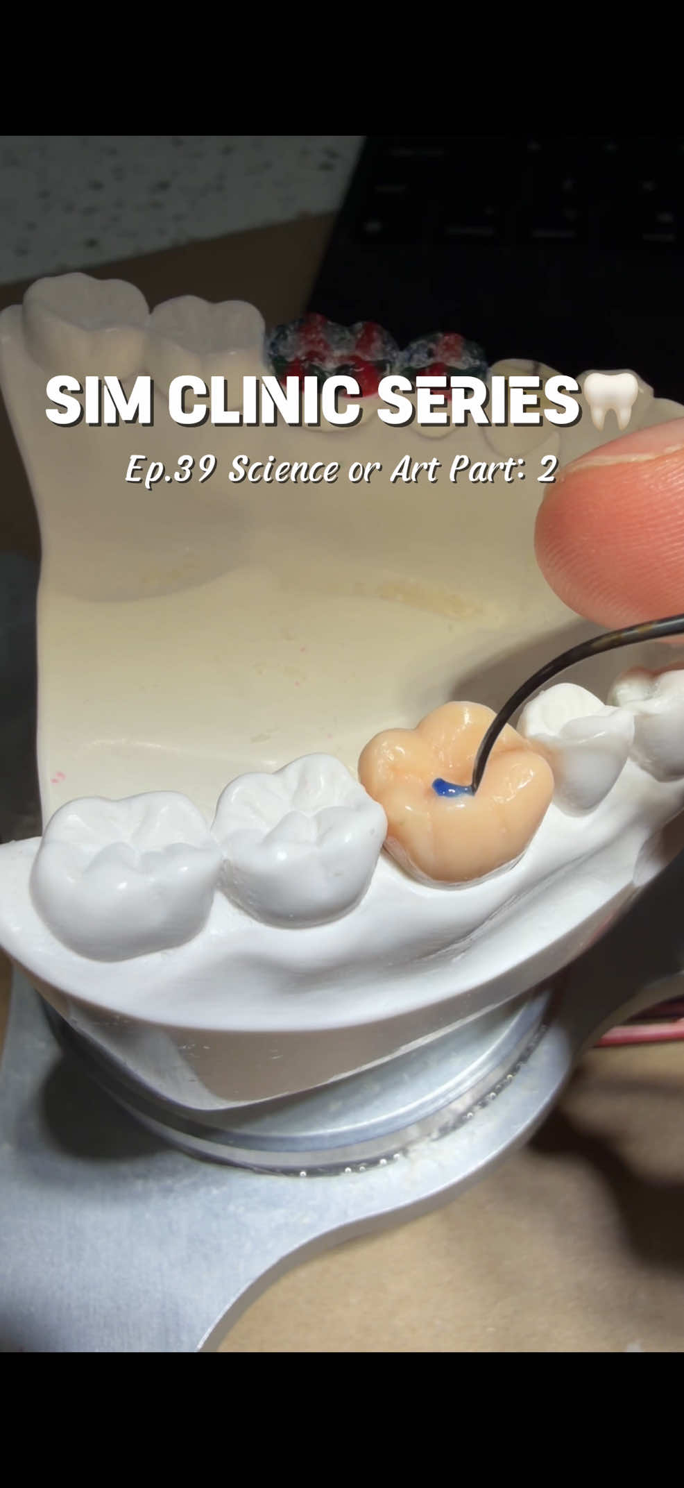 @Norm 🦷 Dental Student