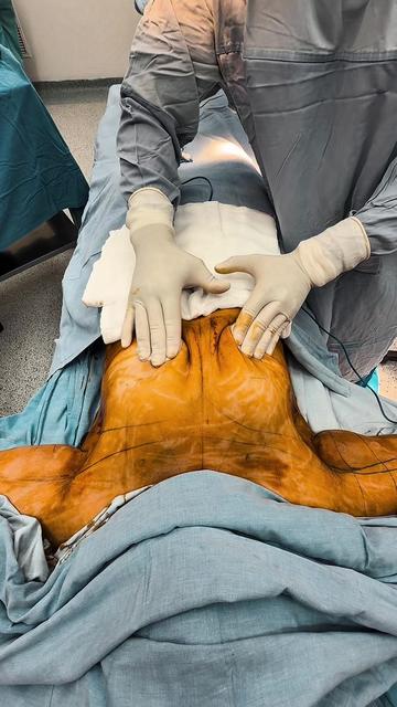 @Dr. Manuel Sevillano