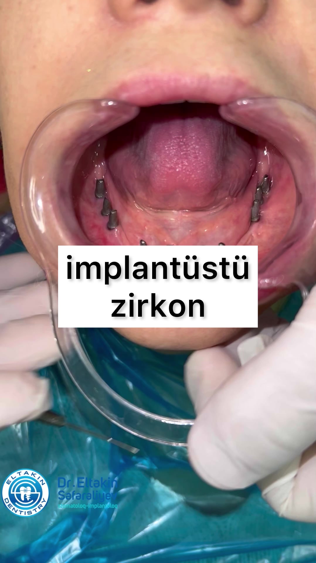 @eltakindentistry
