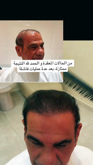 @Dr. Ahmed Alkhateeb