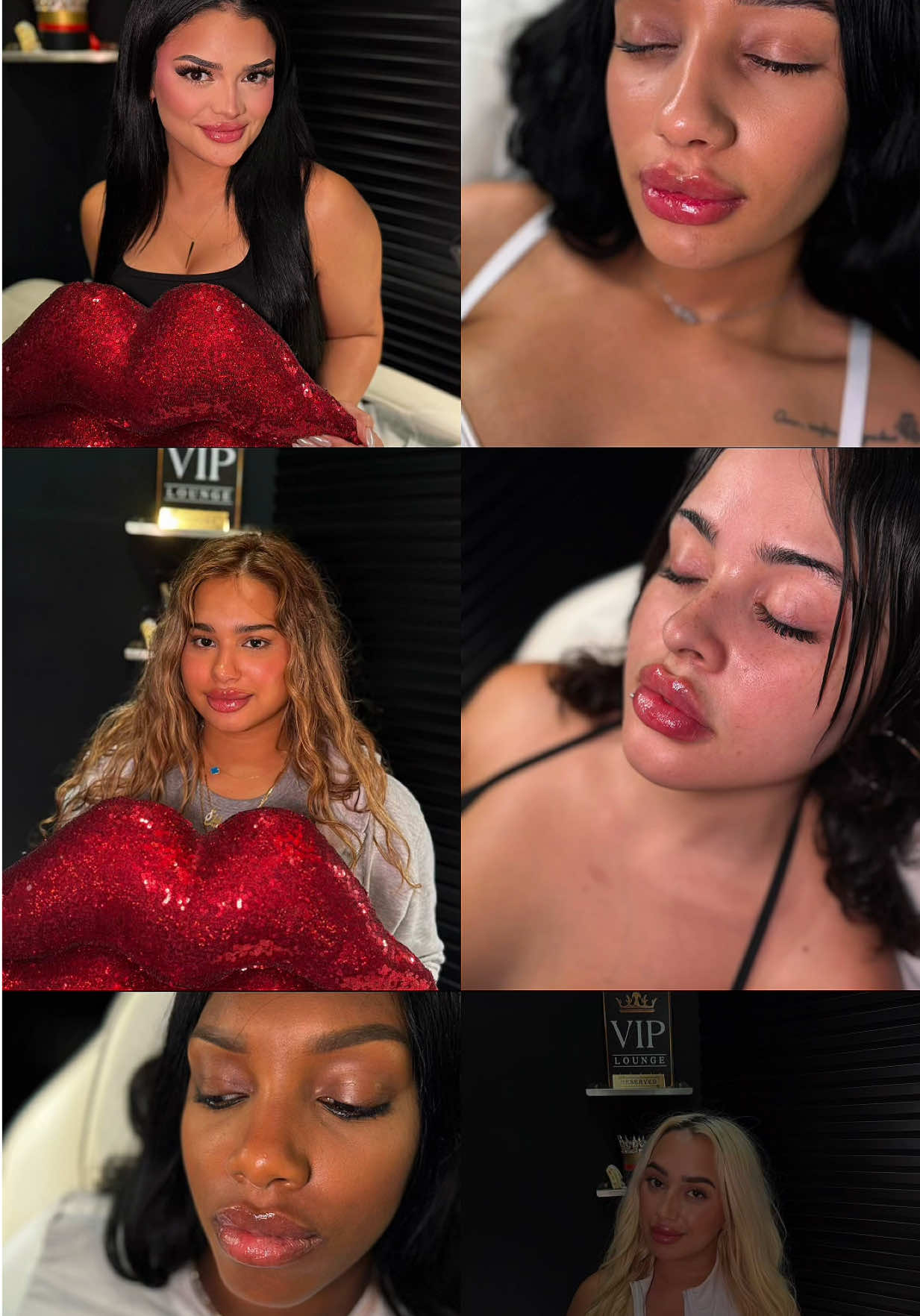 @Lips