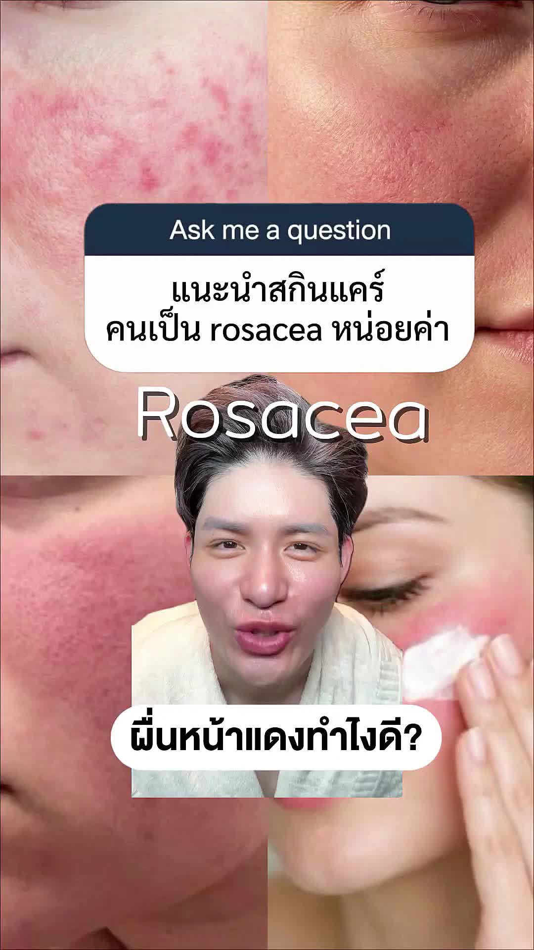 @หนูปอนด์ที่ชอบเลเซ่อร์