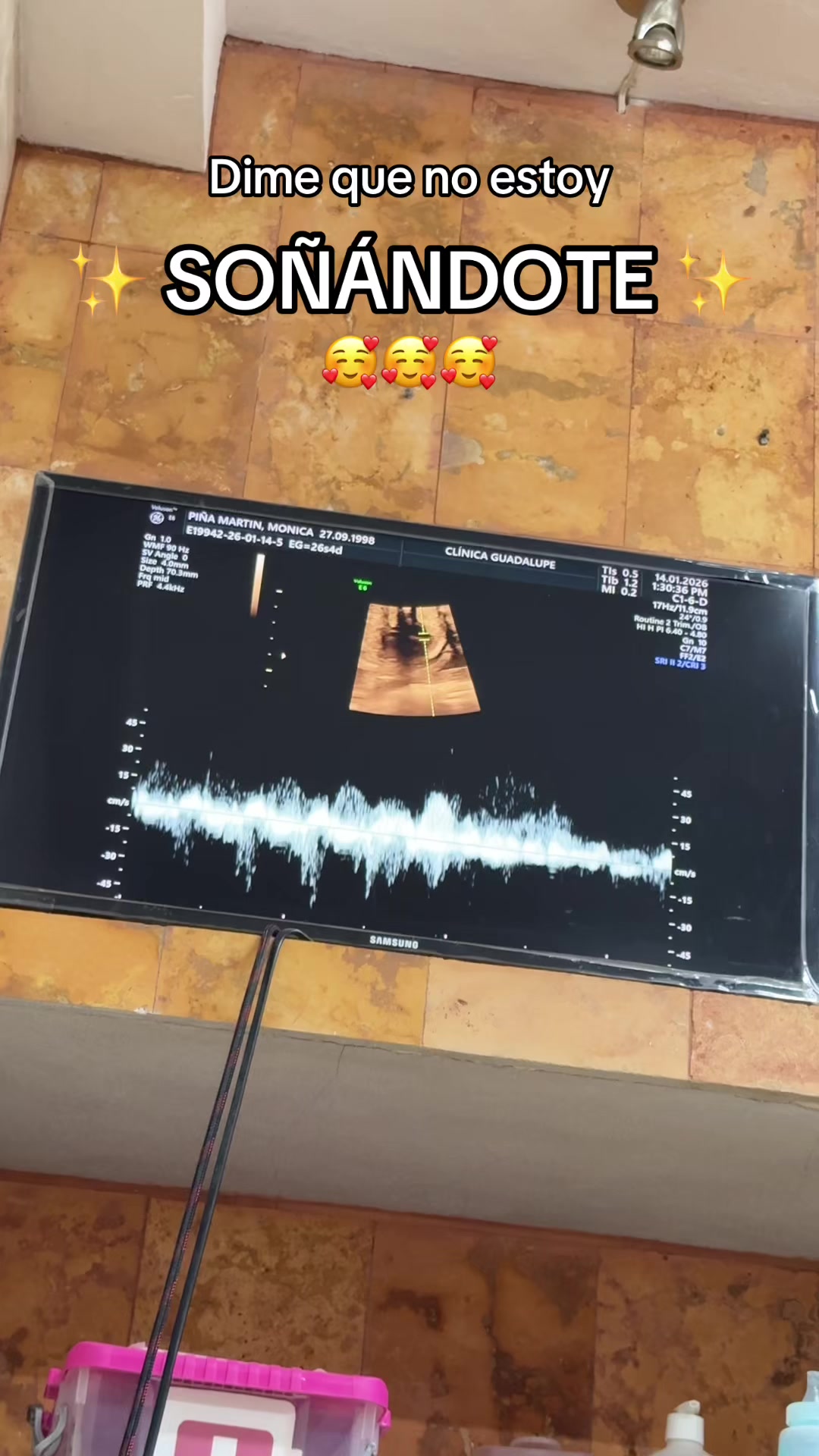 @Monnipi&ntilde;a