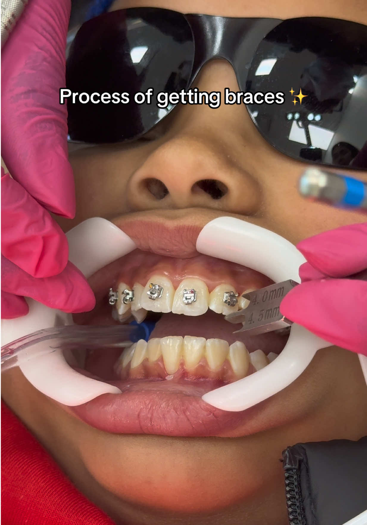 @Pure Orthodontics