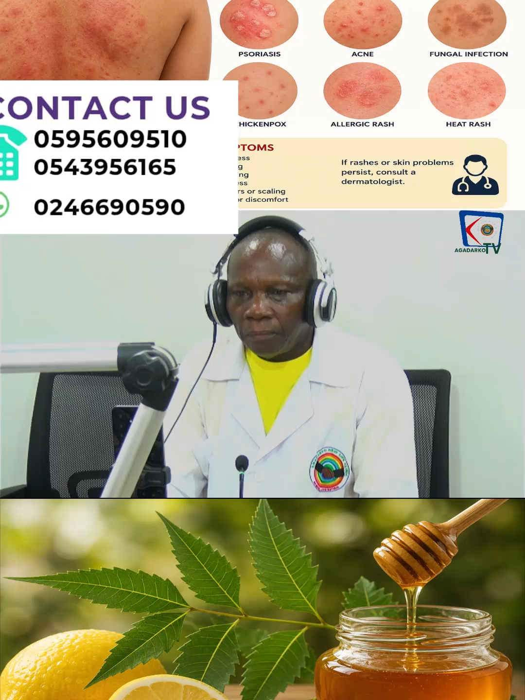 @Agadarko Media
