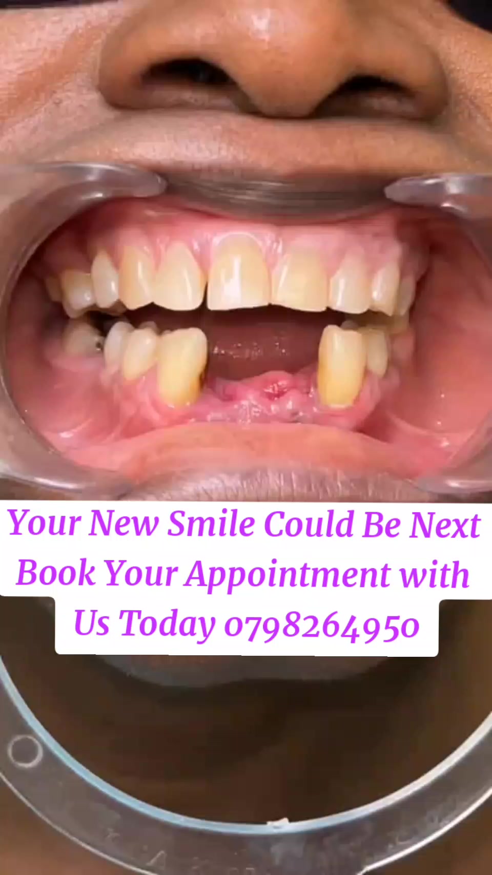 @MIRAHN DENTAL CARE