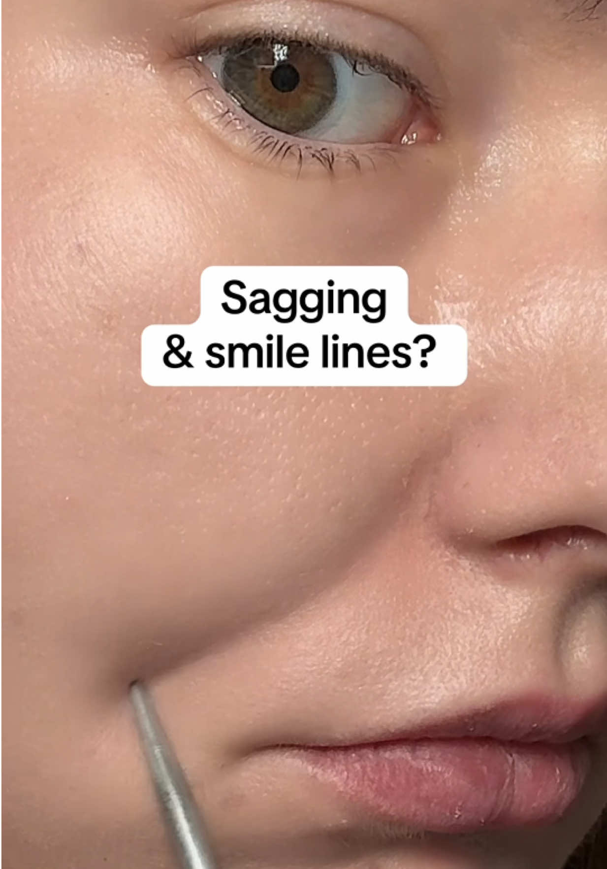 @watermelonsugarskin