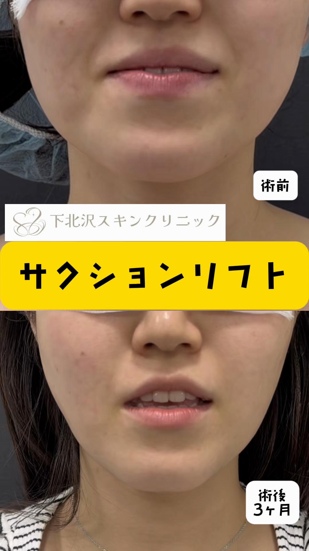@下北沢スキンクリニック院長・こころの美容外科医・保坂宗孝
