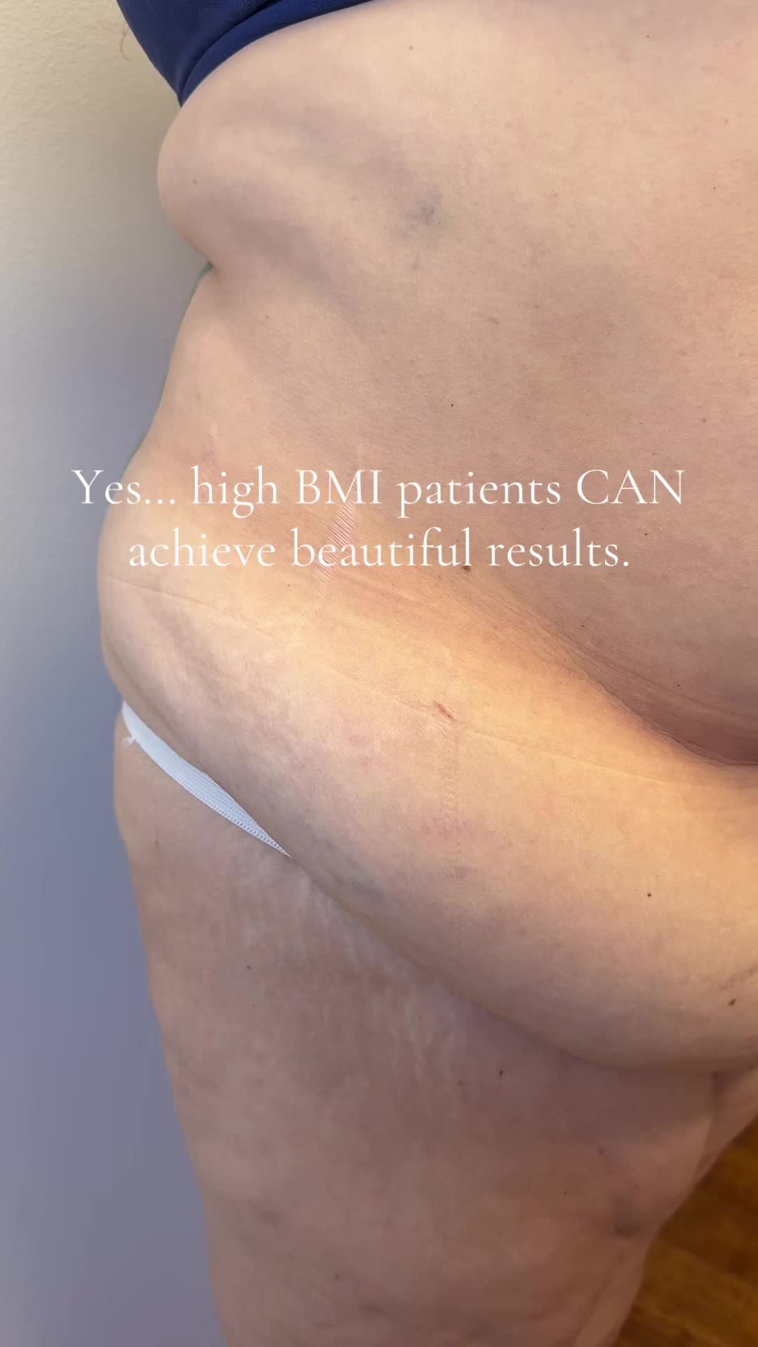 @AESTHETICA LA-Dr.Yaghoubian