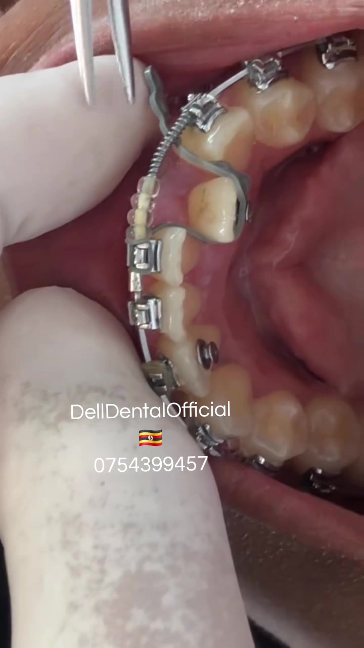 @DellDentalOfficial