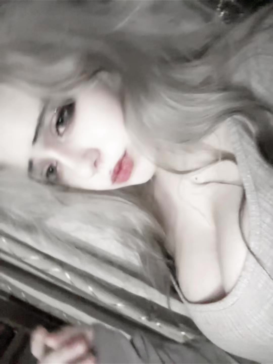 @uglyrosis