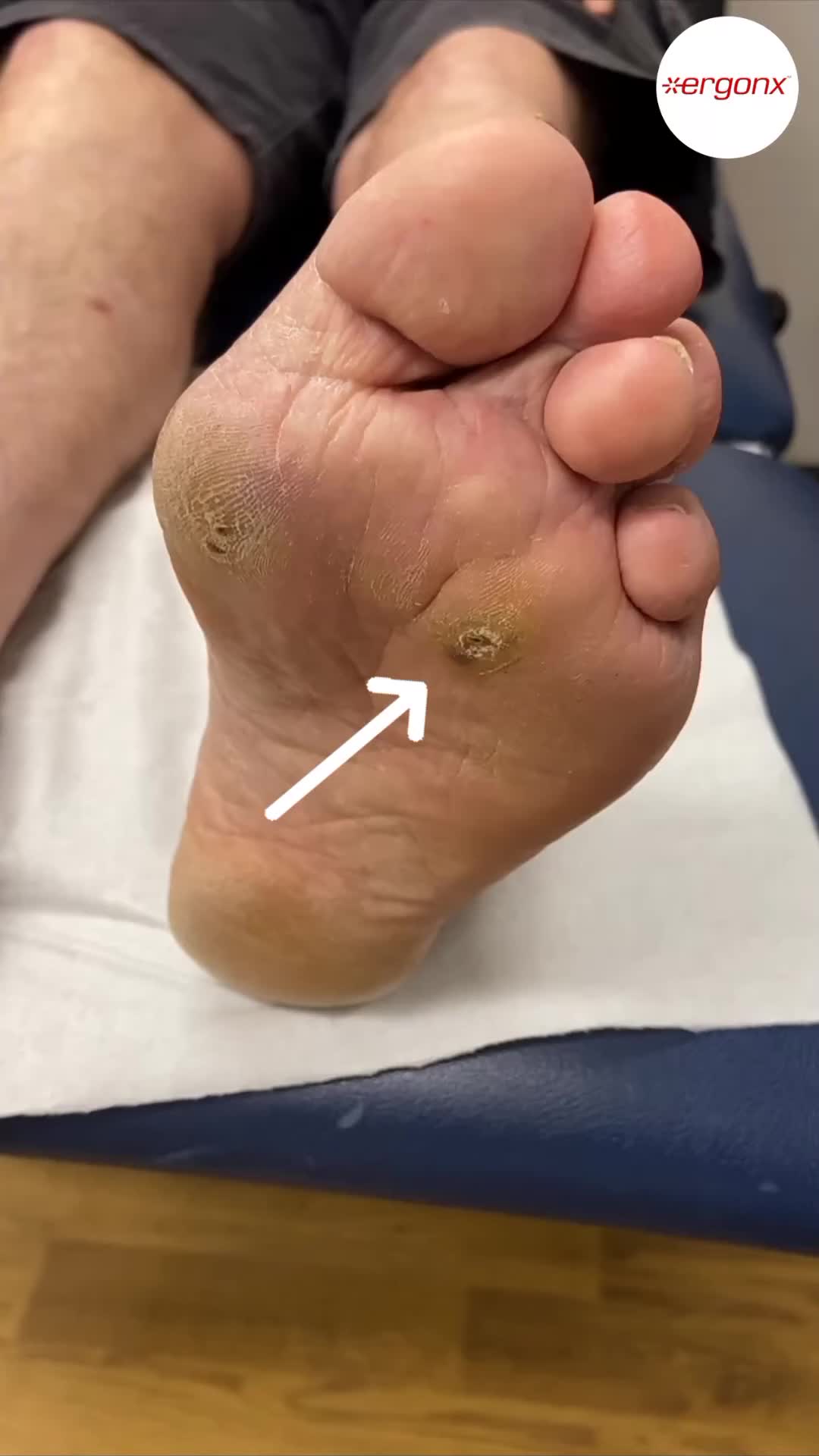 @ergonx