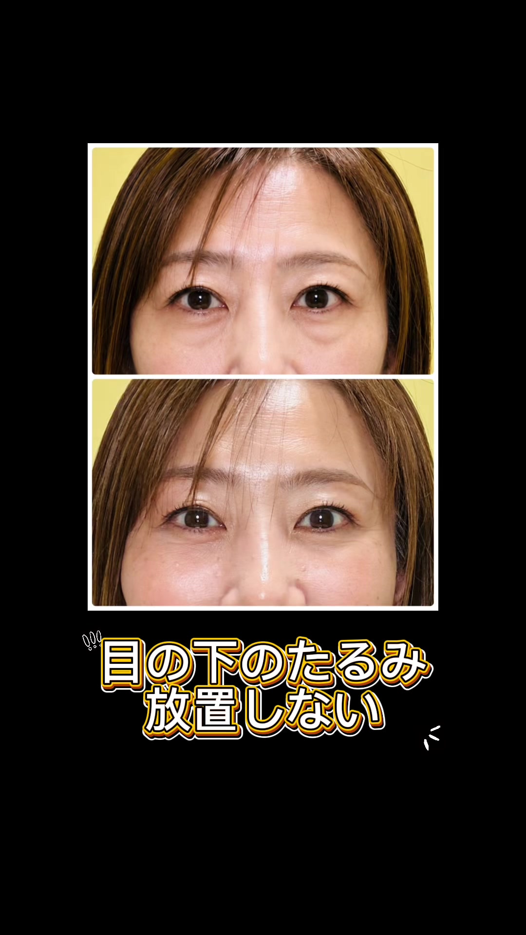 @ピロ/表情筋トレーナー/fgm認定講師