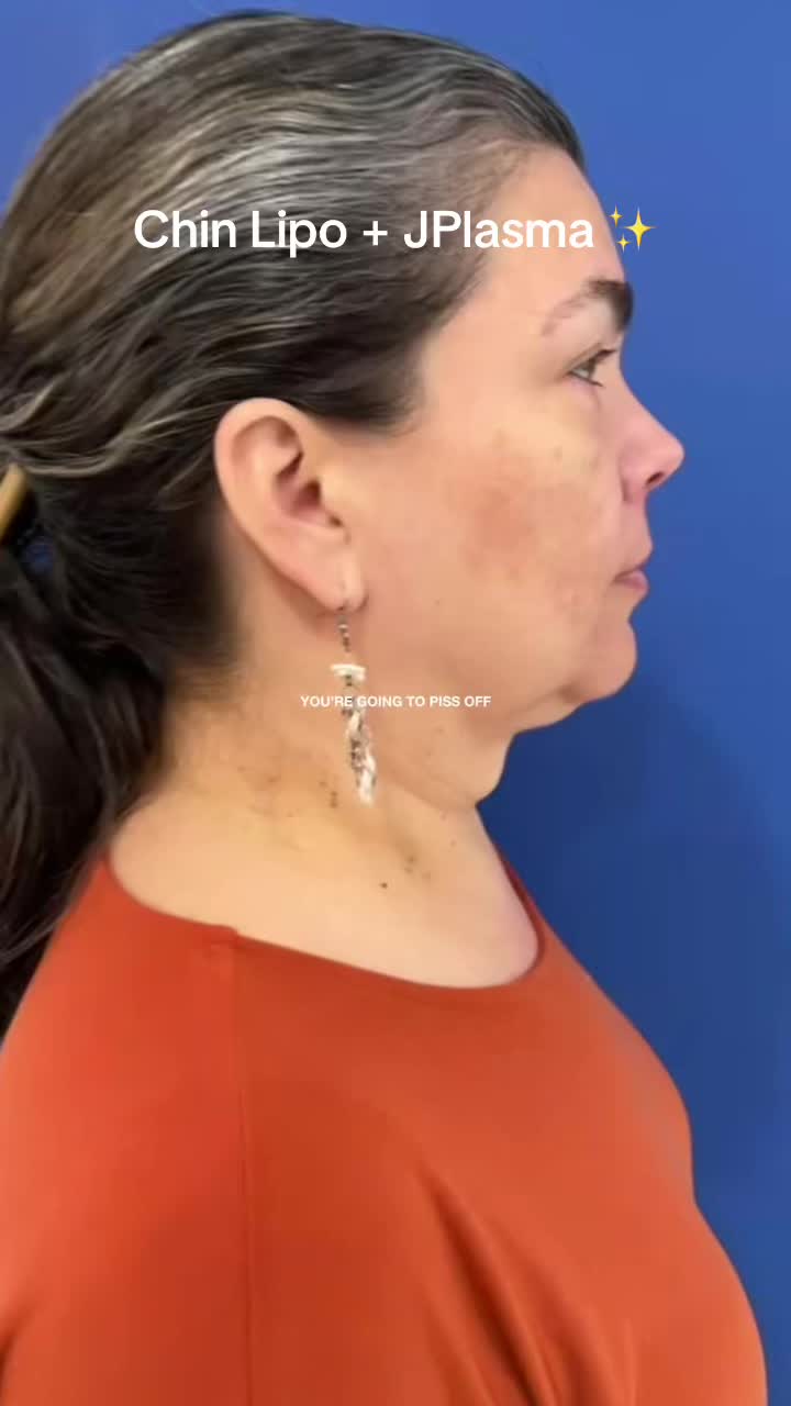 @BioAesthetic305