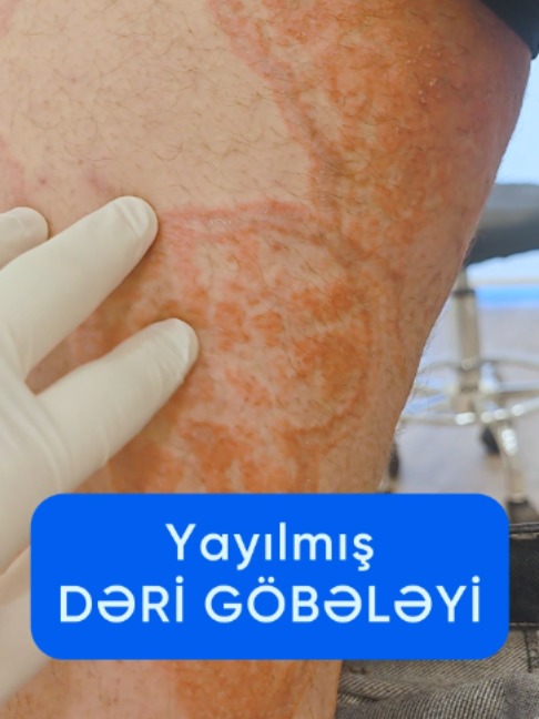 @Dr.Eldar Məmmədov