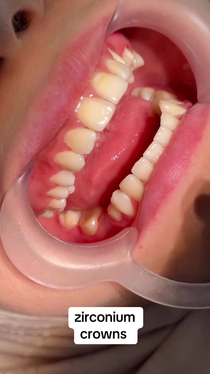 @Aun dental clinic ❤️