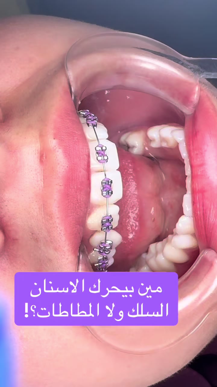 @DR.Tareq Bali