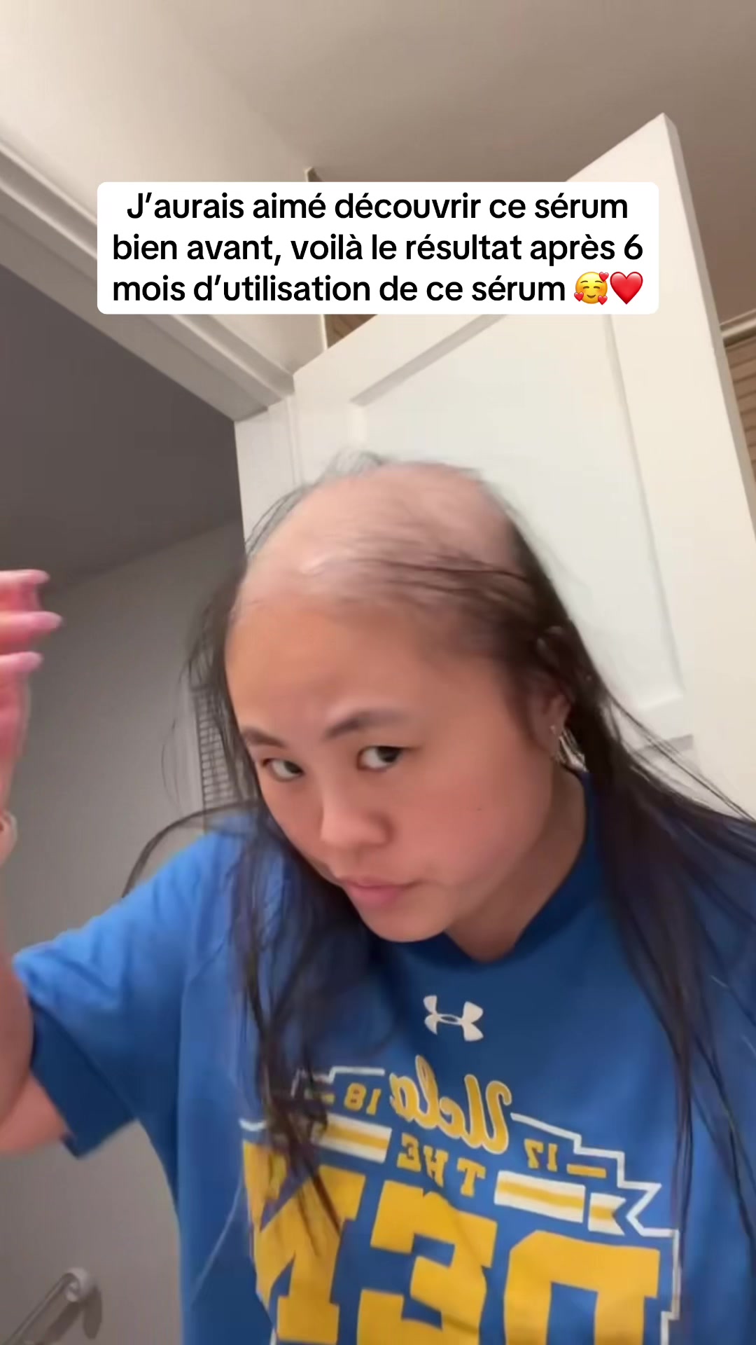 @Lux’Hair Growth