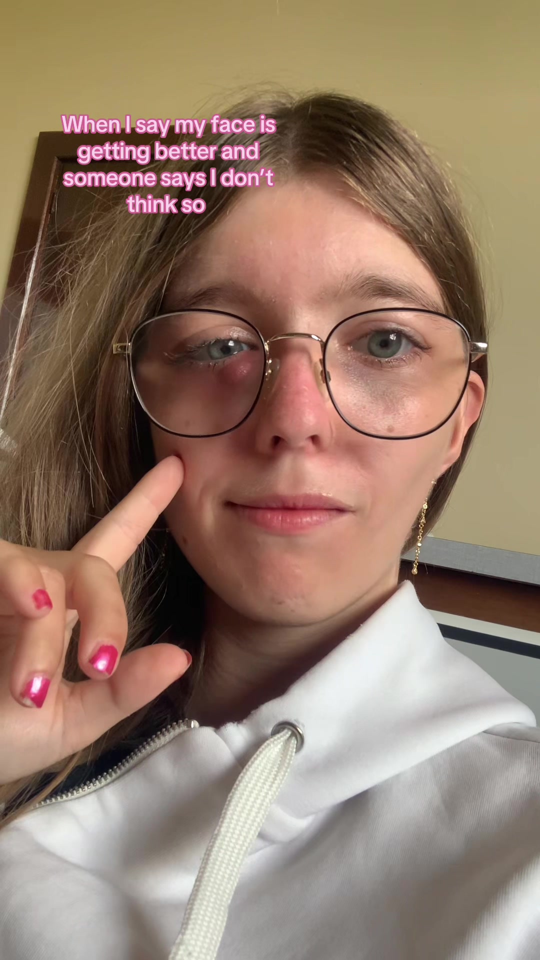 @Alana