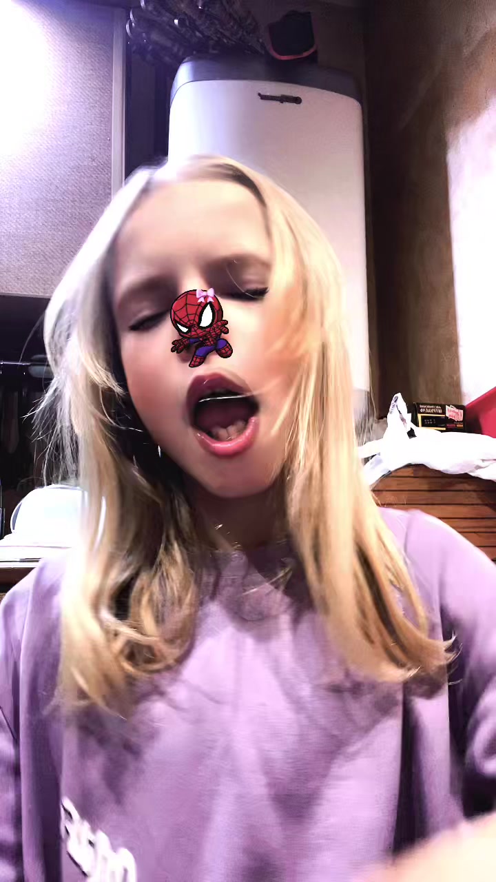 @#ᴛᴠɪsᴛɪᴋ||xx🐿️