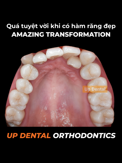 @Nha khoa niềng răng Up Dental