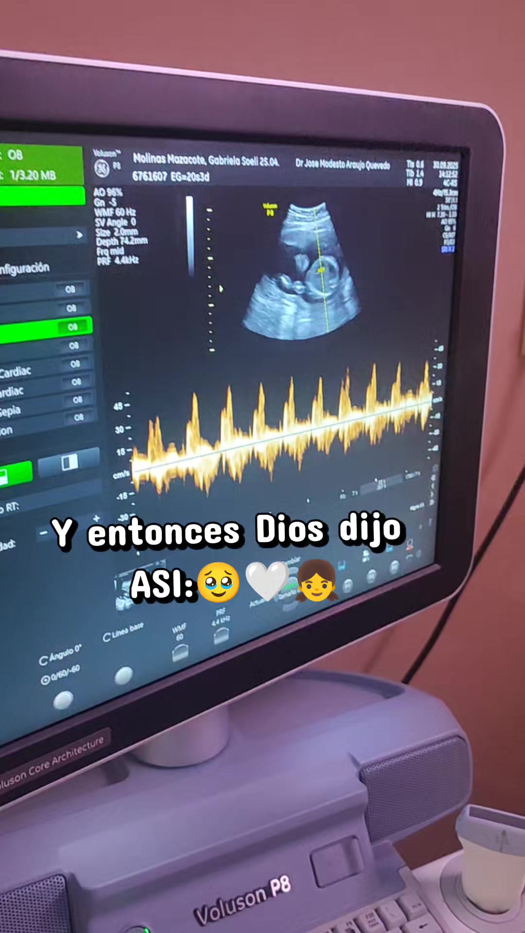 @amadacaceres_14