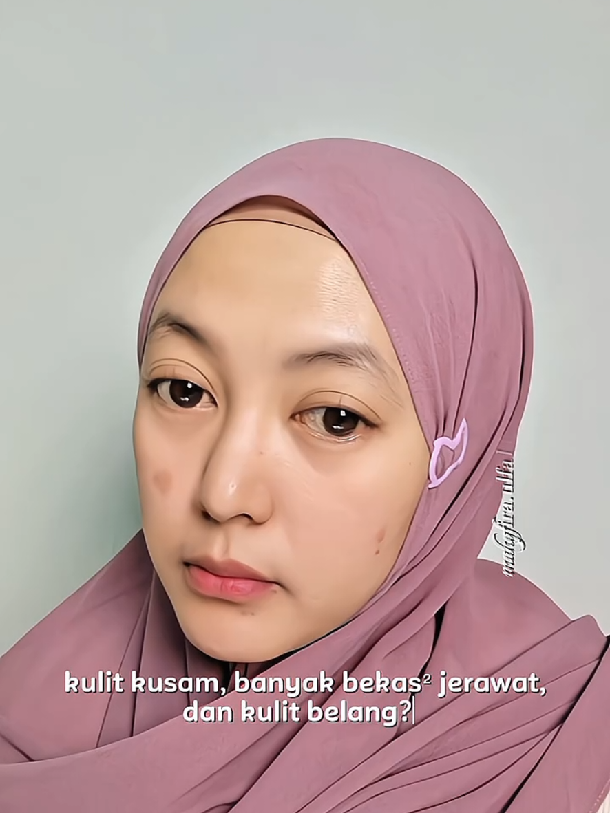 @Ulfa💕