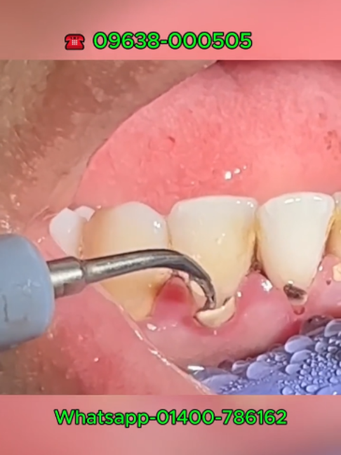 @Tech Dental