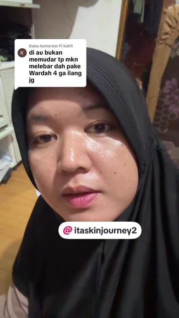 @ita_skinjourney