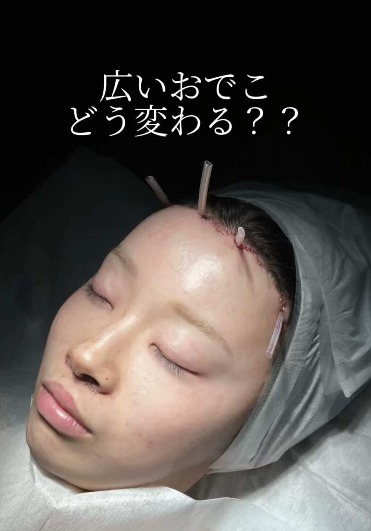 @鼻整形R Beauty CLINIC 副院長👨&zwj;⚕️吉田慧