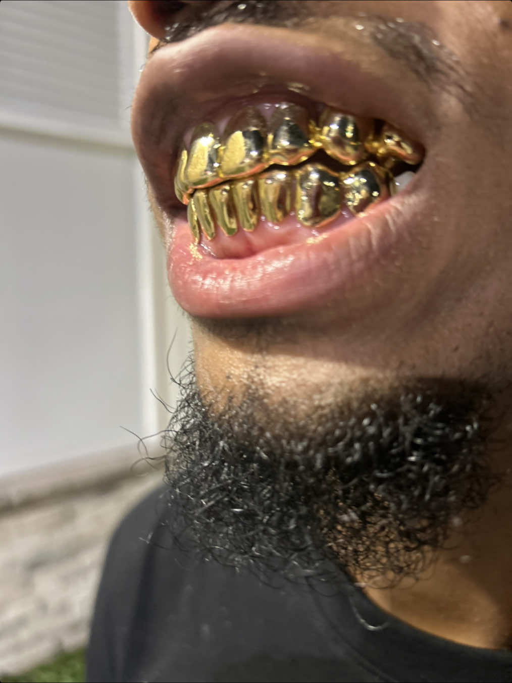 @LouieDaJewelryGuy