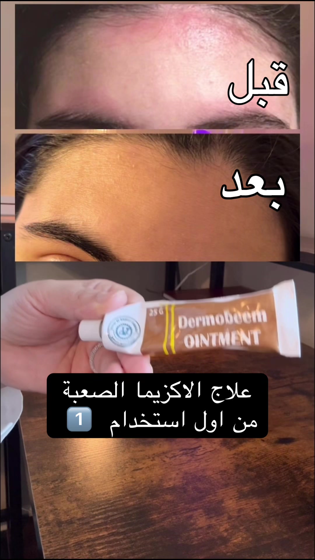 @Angal🎓💼🕶️