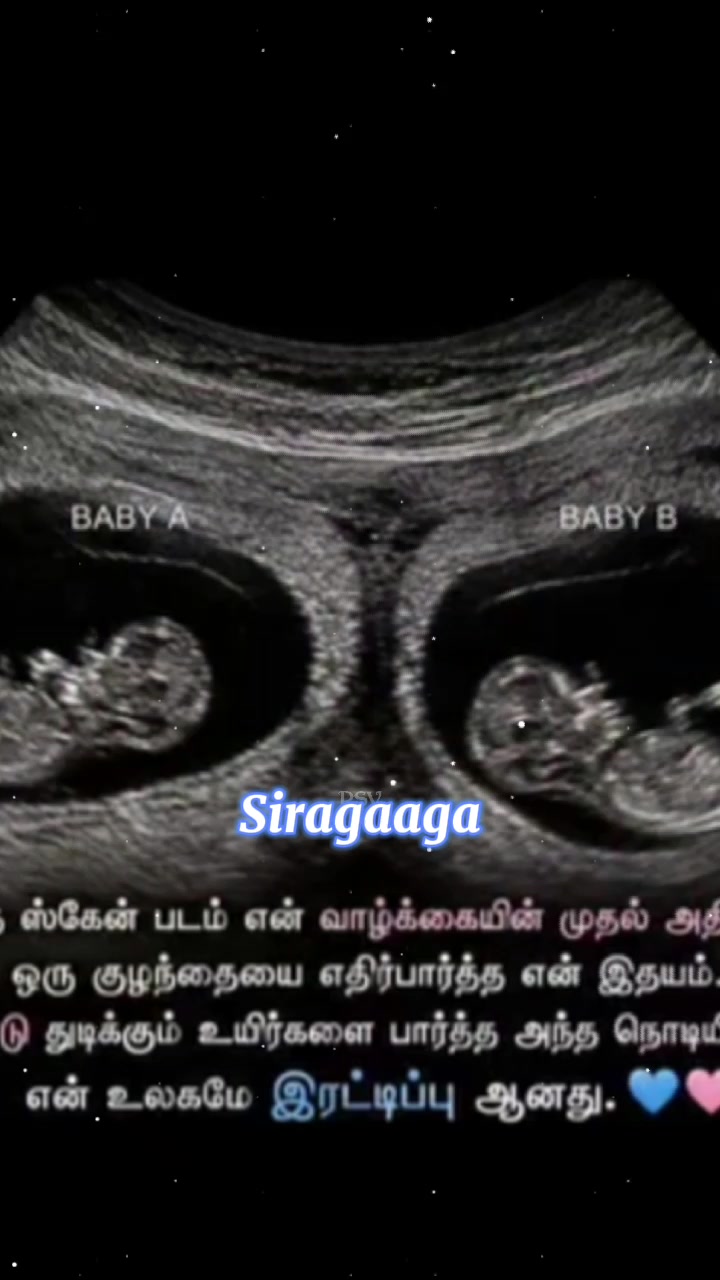 @my love sinu mama love  kalai