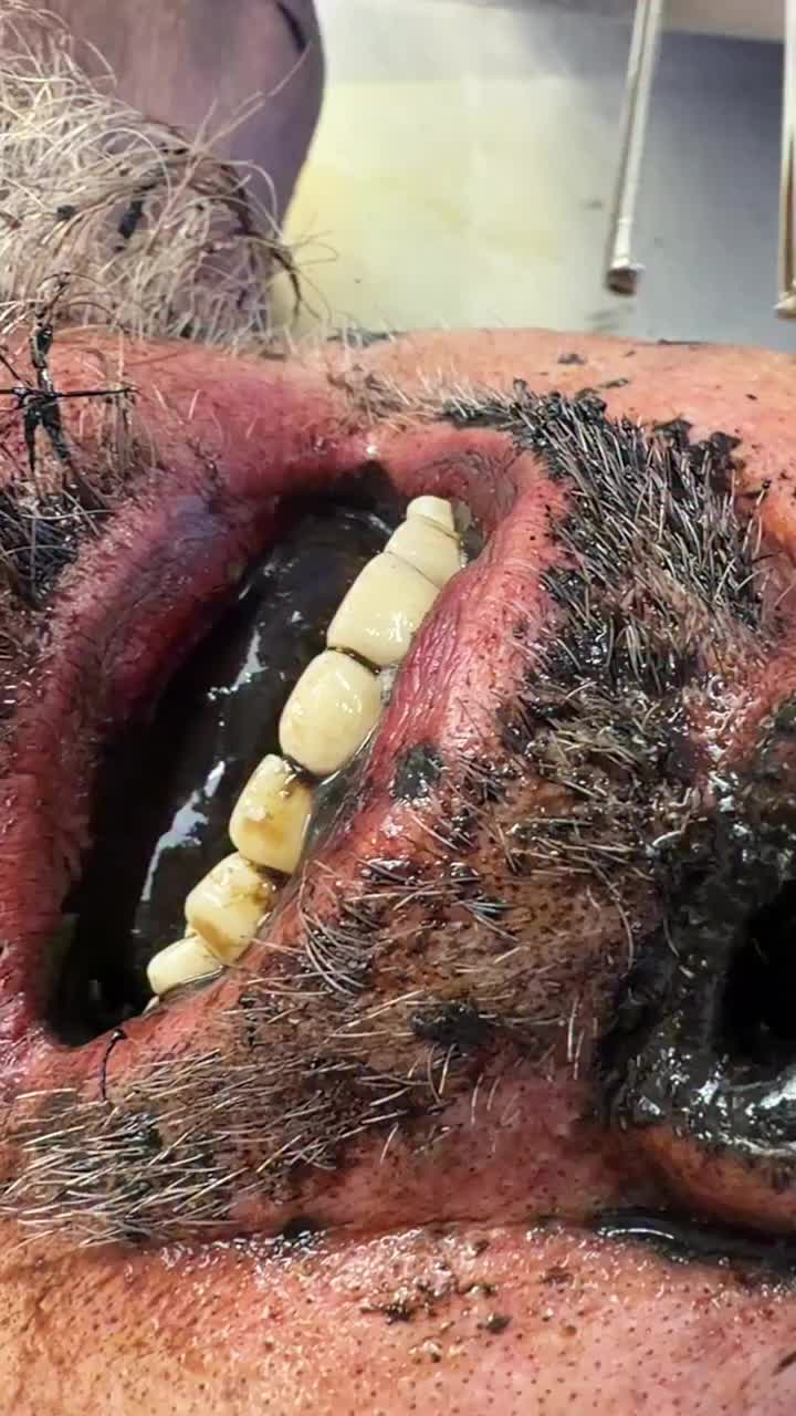 @Aɴɴᴀʙᴇʟ