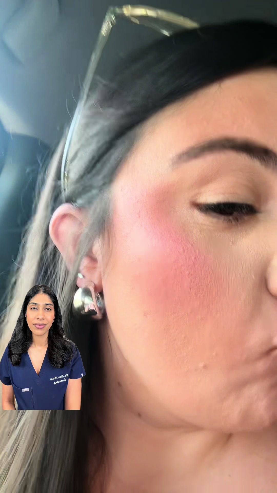 @Dr. Neera, Skin Surgeon