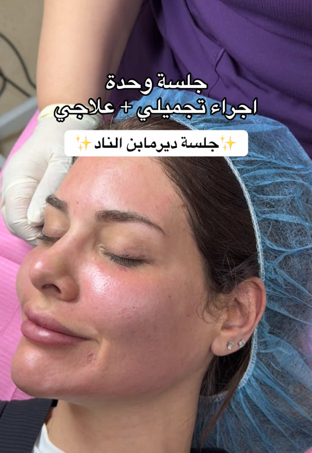 @أخصائية البشرة نورا