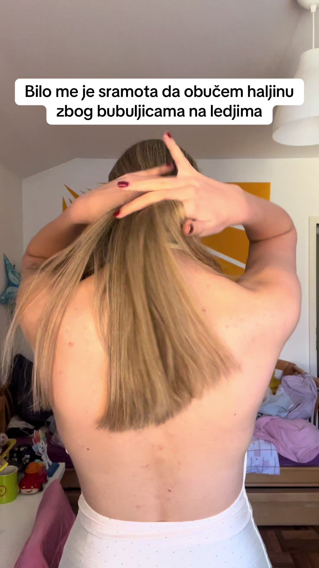 @obrisii.flekice