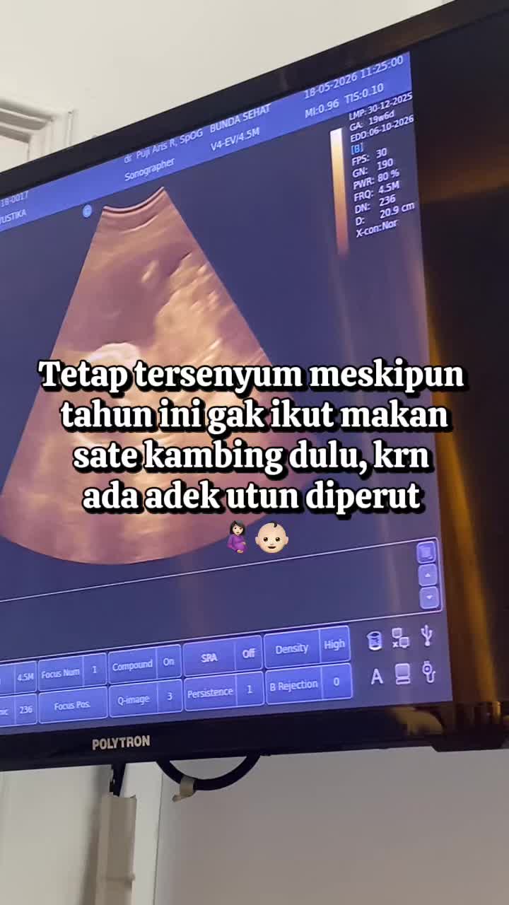 @Tica