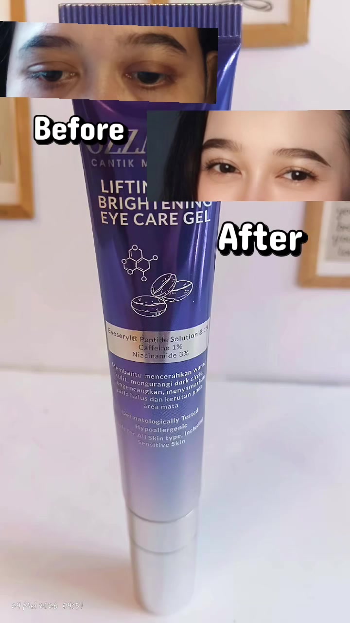 @Aini Nani