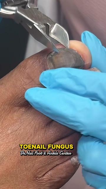 @Deniel Foot and Ankle Center