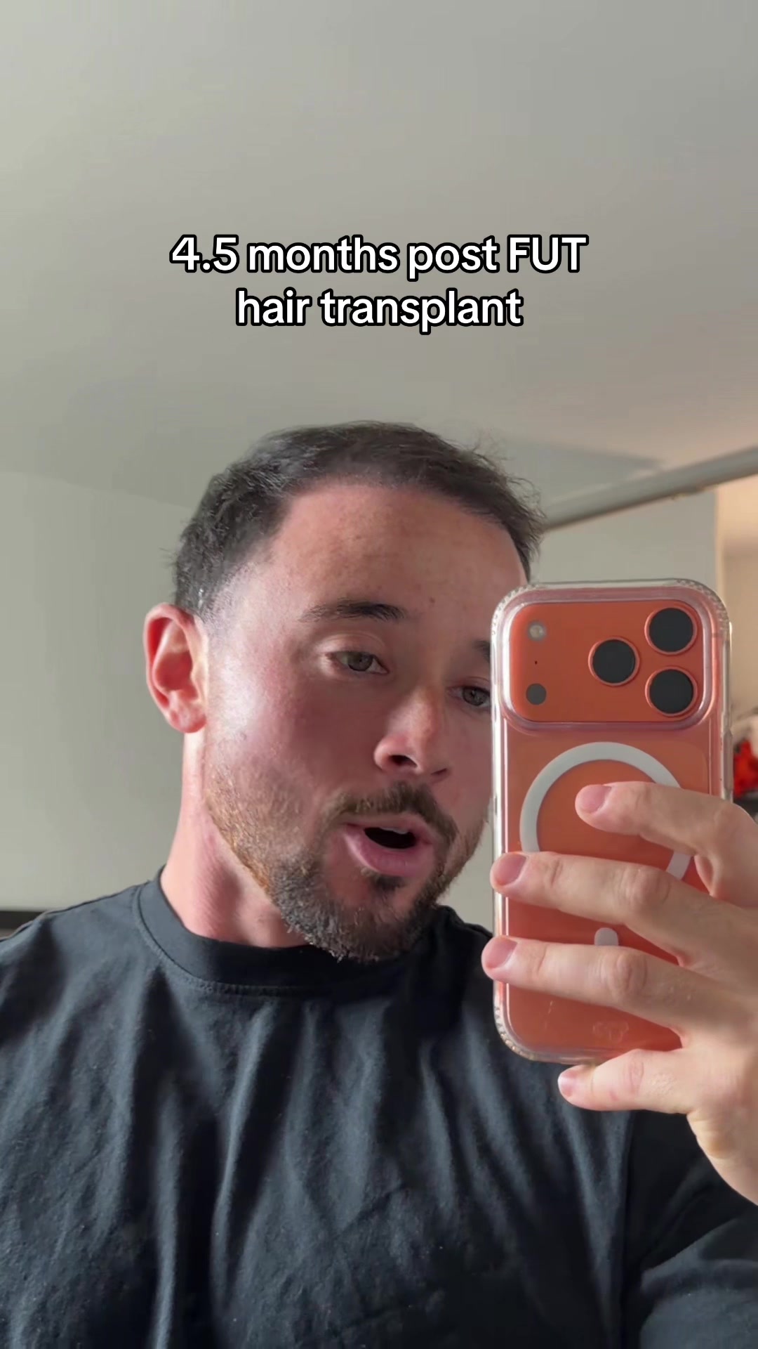 @Liam Lazore