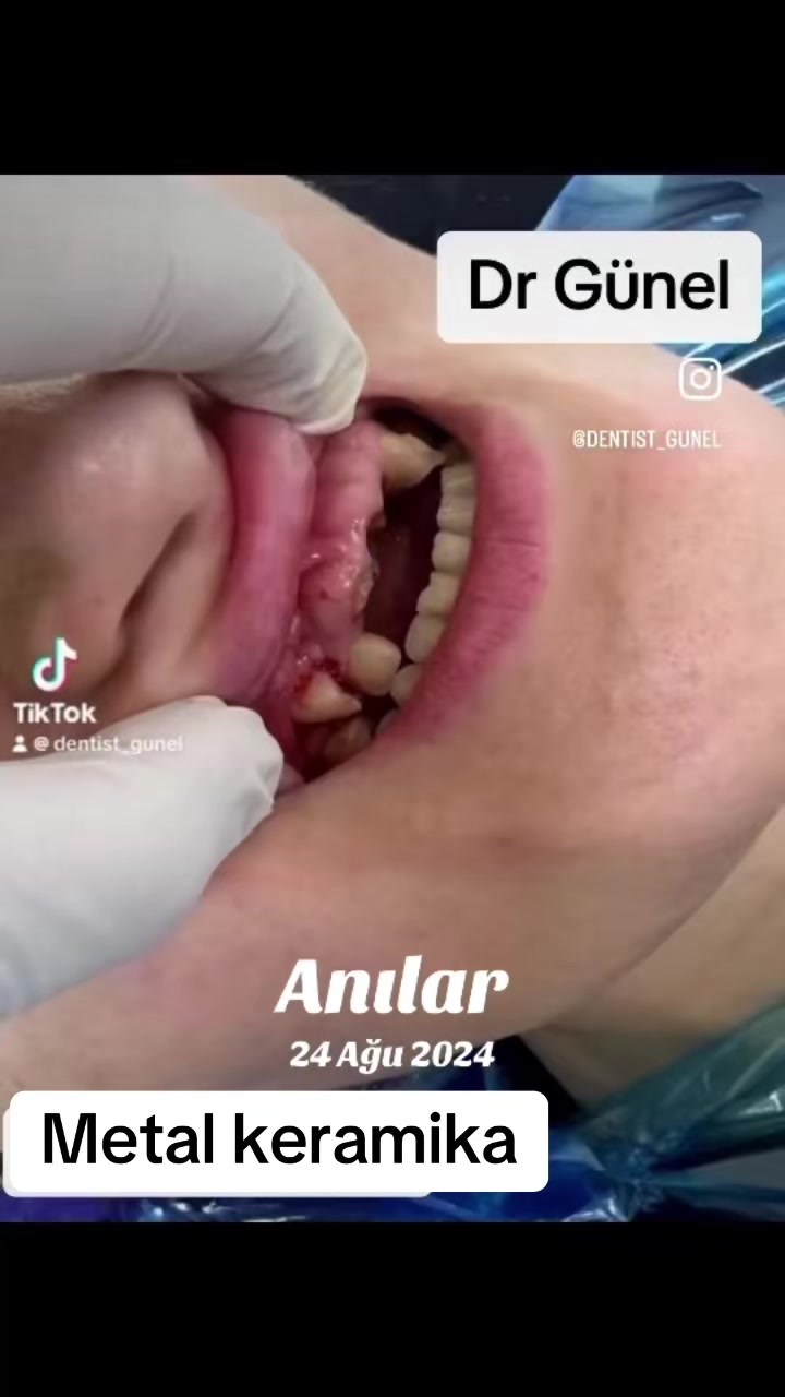 @Dentist_Günel